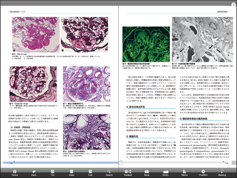 新しいコレクション 腎生検病理アトラス改訂版 健康・医学 - www 