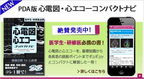 top-shinecho-nowonsale.png